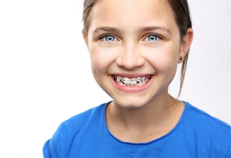 When is the Right Time for an Orthodontic Consultation?