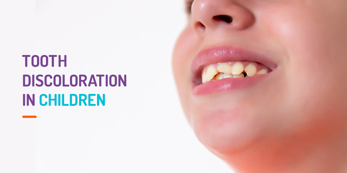 Tooth discoloration in children