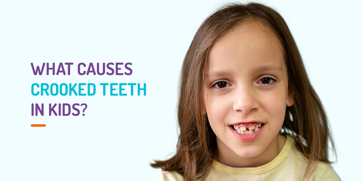 What causes crooked teeth in kids