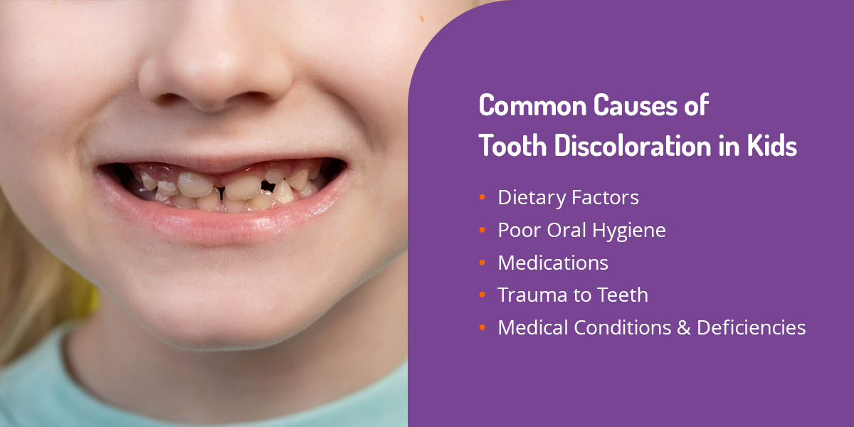 Common causes of tooth discoloration in kids